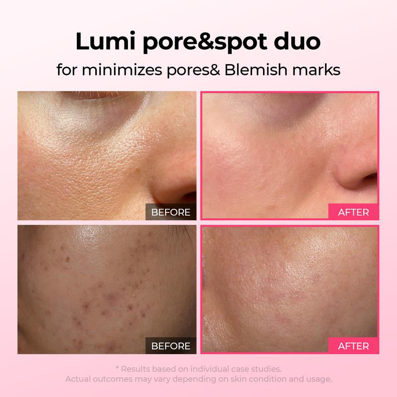 Verfeinert Poren & mildert Pickelmale