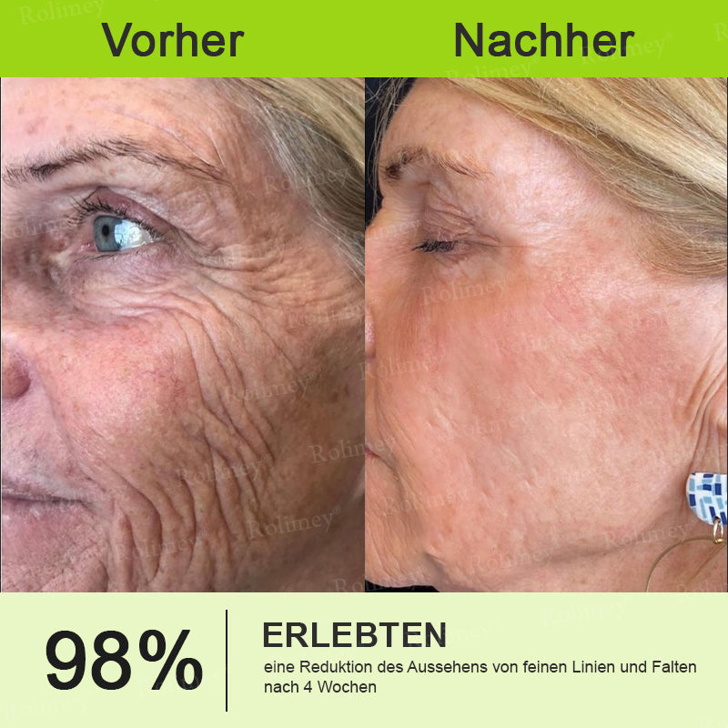 Rolimey® Retinol & Botox Shot » Straffende Gesichtscreme gegen Falten