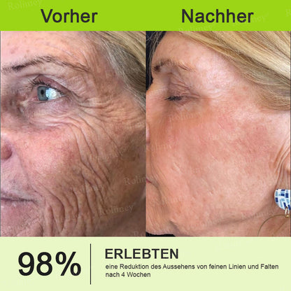 Rolimey® Retinol & Botox Shot » Straffende Gesichtscreme gegen Falten