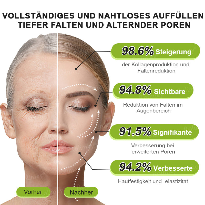 Rolimey® Retinol & Botox Shot » Straffende Gesichtscreme gegen Falten