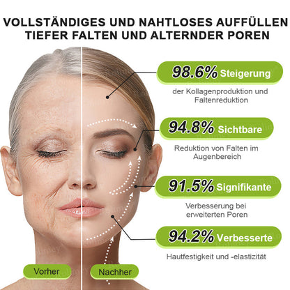 Rolimey® Retinol & Botox Shot » Straffende Gesichtscreme gegen Falten