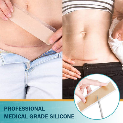 Ourlyard® Hyaluron-Nano-Mikronadel-Tape: Intensive Narbenpflege & Hautregeneration