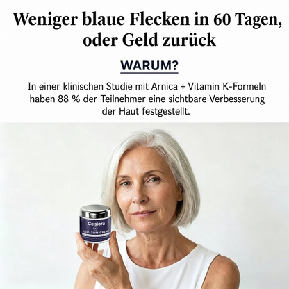 💥 ÜBER 75.000-MAL VERKAUFT – Celsiora® Intensivpflege bei blauen Flecken & empfindlicher Haut