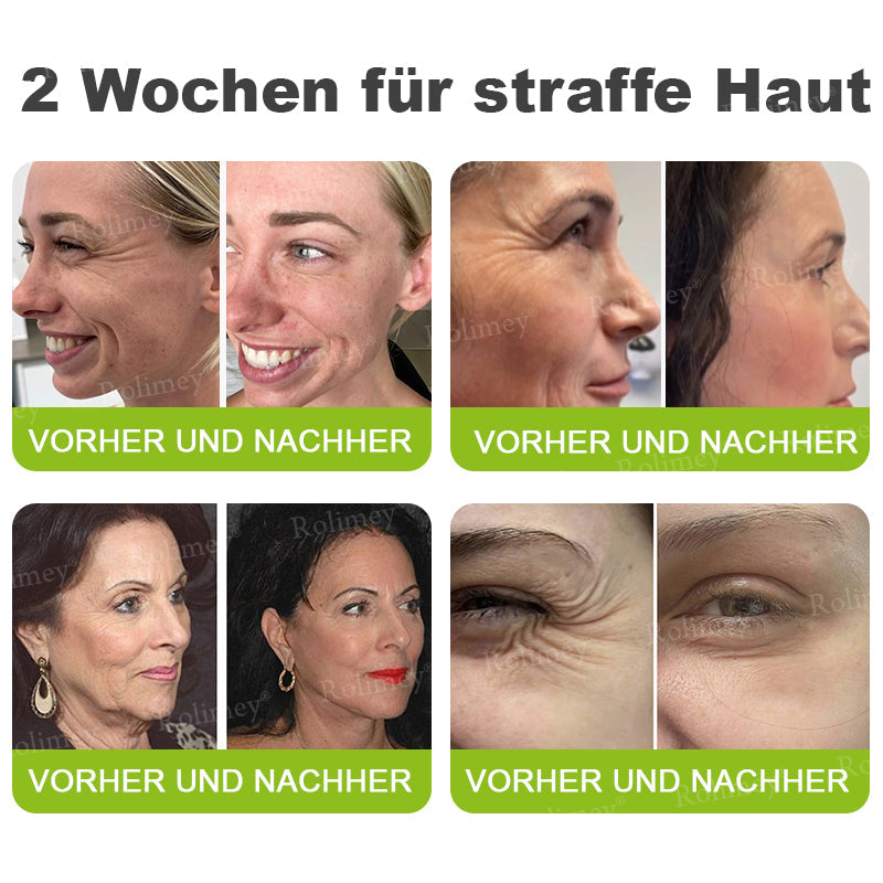 Rolimey® Retinol & Botox Shot » Straffende Gesichtscreme gegen Falten