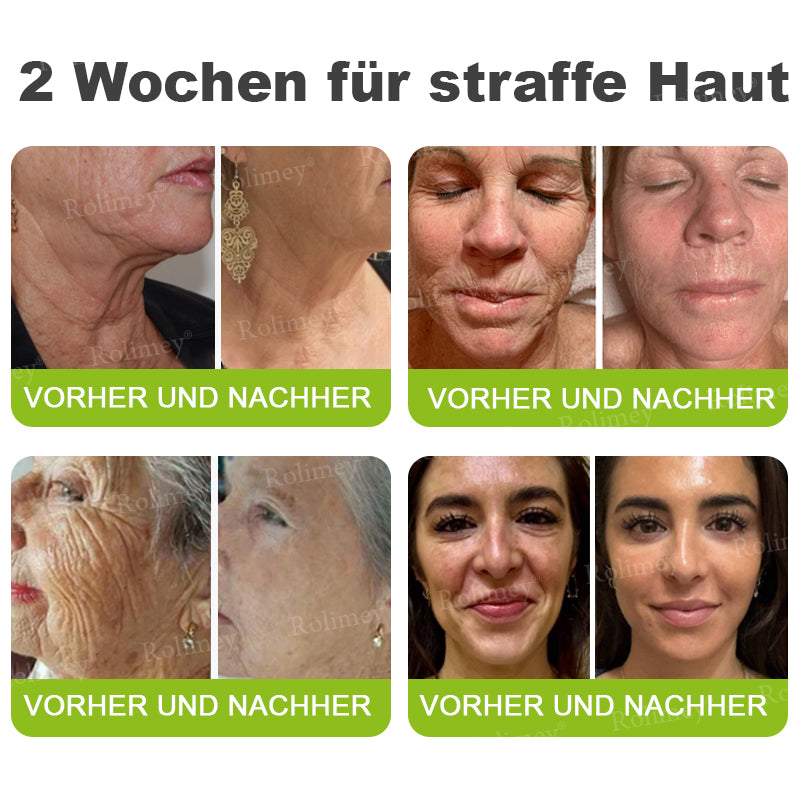 Rolimey® Retinol & Botox Shot » Straffende Gesichtscreme gegen Falten