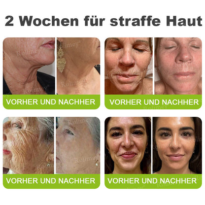 Rolimey® Retinol & Botox Shot » Straffende Gesichtscreme gegen Falten