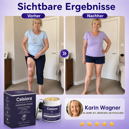 👩‍⚕️🌷 Celsiora® Intensiv-Pflegecreme für empfindliche, zu blauen Flecken neigende Haut